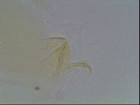 Echiniscus canadensis image