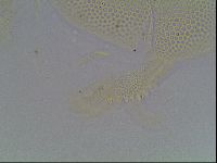 Echiniscus canadensis image