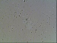 Echiniscus canadensis image