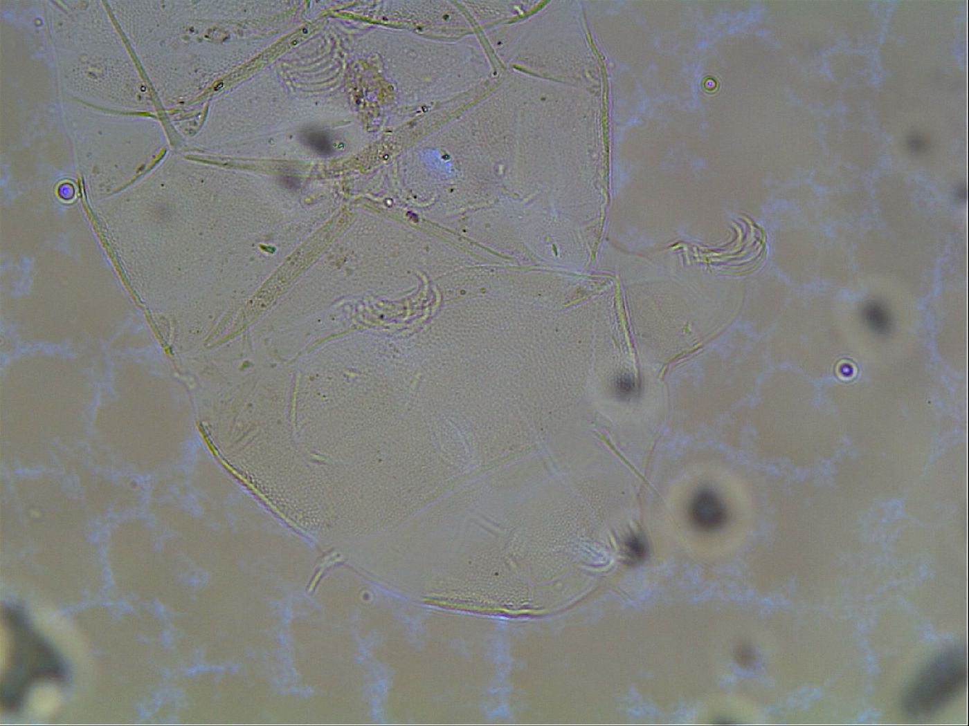 Echiniscus canadensis image