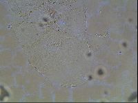 Echiniscus canadensis image