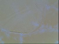 Echiniscus canadensis image