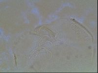 Echiniscus canadensis image