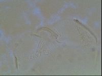 Echiniscus canadensis image