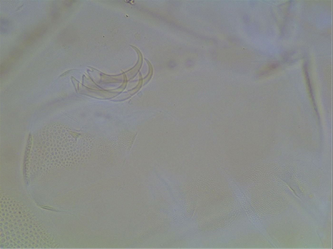 Echiniscus canadensis image