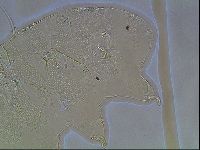 Echiniscus canadensis image