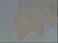 Echiniscus canadensis image
