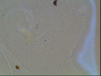 Echiniscus canadensis image