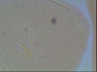 Echiniscus canadensis image