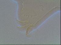 Echiniscus canadensis image