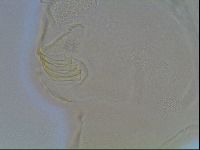 Echiniscus canadensis image