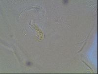 Echiniscus canadensis image