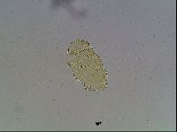 Echiniscus canadensis image