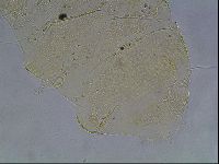 Echiniscus canadensis image