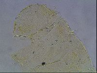 Echiniscus canadensis image