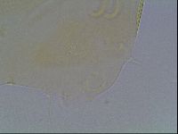 Echiniscus canadensis image