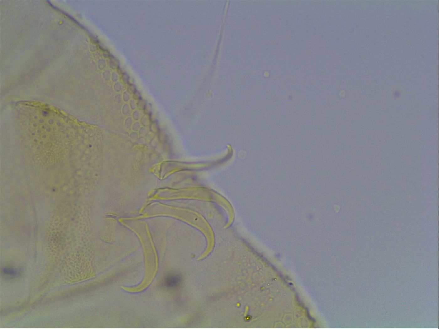 Echiniscus canadensis image