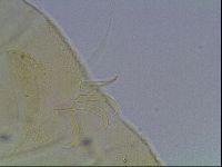 Echiniscus canadensis image