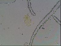 Echiniscus canadensis image