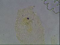 Echiniscus canadensis image
