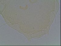 Echiniscus canadensis image
