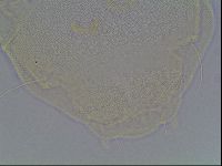 Echiniscus canadensis image