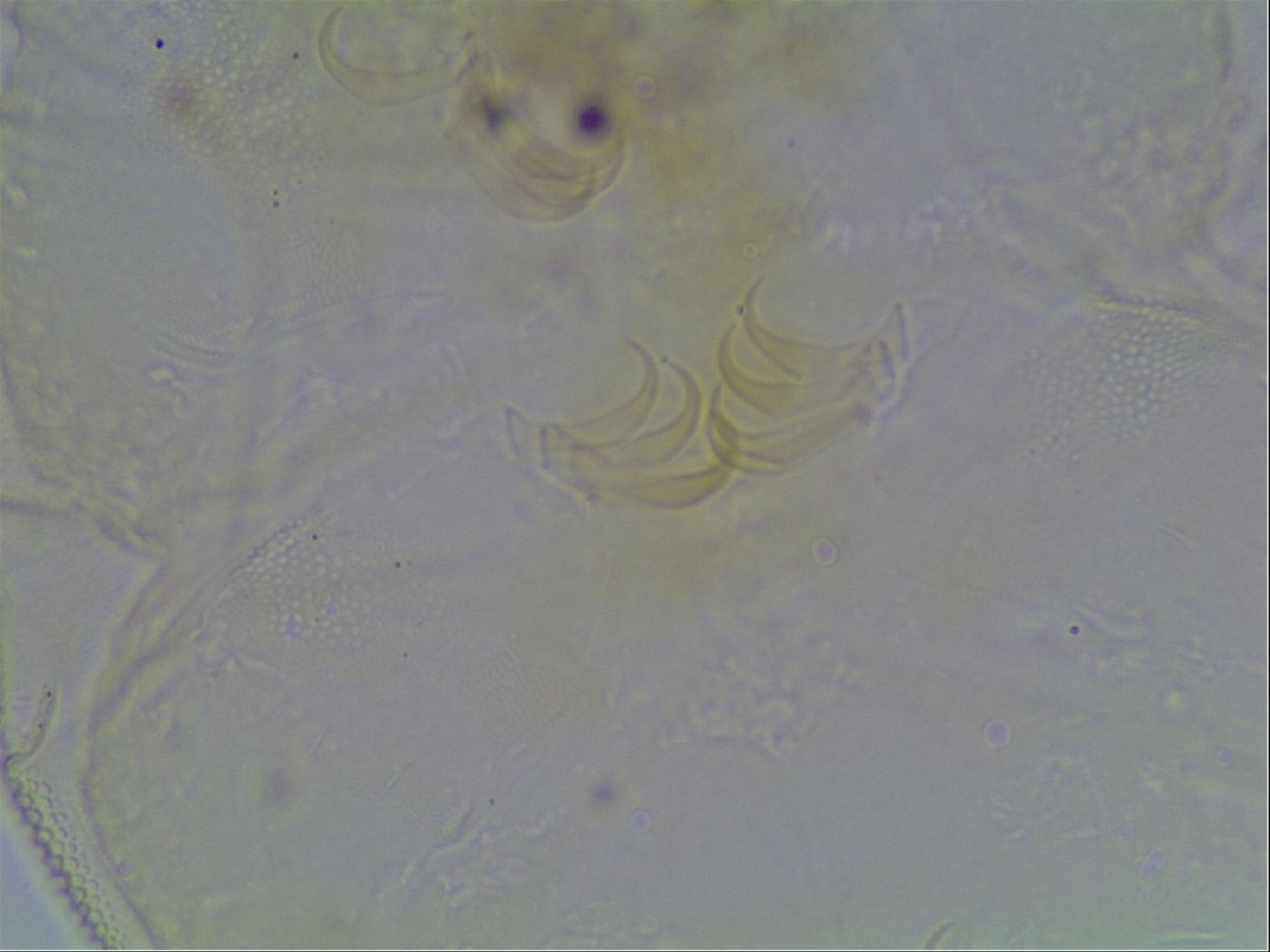 Echiniscus canadensis image