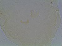 Echiniscus canadensis image
