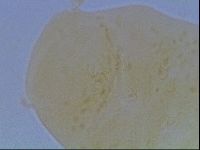 Echiniscus cavagnaroi image