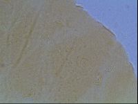 Echiniscus cavagnaroi image