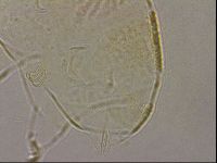 Echiniscus cavagnaroi image