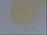 Echiniscus cavagnaroi image