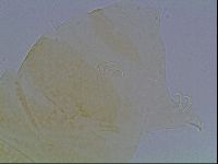 Echiniscus cavagnaroi image