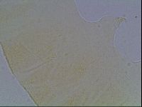 Echiniscus cavagnaroi image