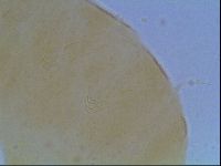Echiniscus cavagnaroi image