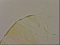 Echiniscus cavagnaroi image