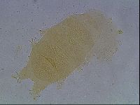 Echiniscus cavagnaroi image