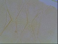 Echiniscus cavagnaroi image