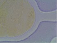 Echiniscus cavagnaroi image
