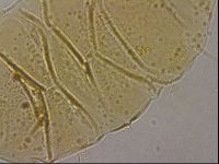 Echiniscus cavagnaroi image