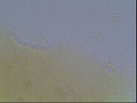 Echiniscus cavagnaroi image