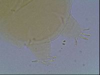 Echiniscus cavagnaroi image