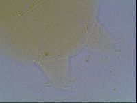 Echiniscus cavagnaroi image