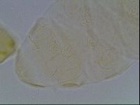 Echiniscus cavagnaroi image