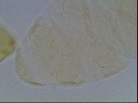 Echiniscus cavagnaroi image