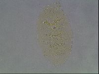 Echiniscus cavagnaroi image