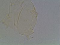 Echiniscus cavagnaroi image
