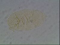 Echiniscus cavagnaroi image