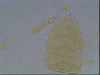 Echiniscus duboisi image