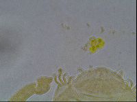 Echiniscus duboisi image